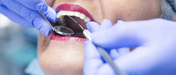 Best Emergency Dental Surgery in Woodacre, CA